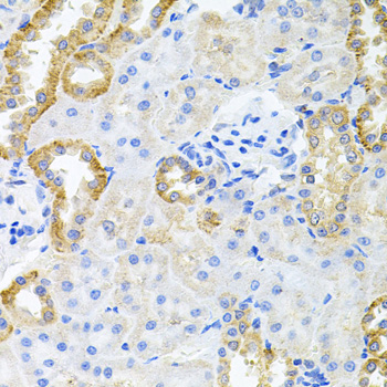 Anti-STRN3 Antibody (CAB6756)