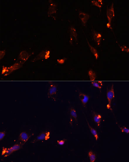 Anti-IKKEpsilon Antibody (CAB14093)