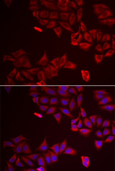 Anti-LGALS8 Antibody (CAB6646)