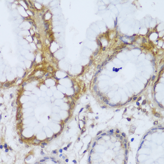 Anti-GCC2 Antibody (CAB13814)