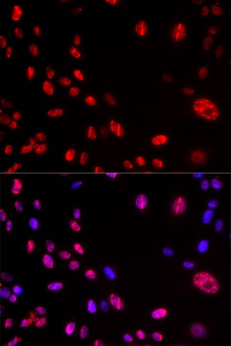 Anti-Phospho-ATM-S1981 Antibody (CABP0008)