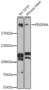 Anti-PDGFRA Antibody (CAB2103)