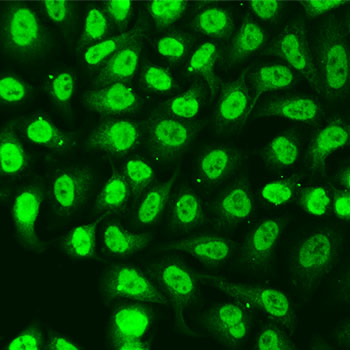 Anti-KU70 Antibody (CAB2076)