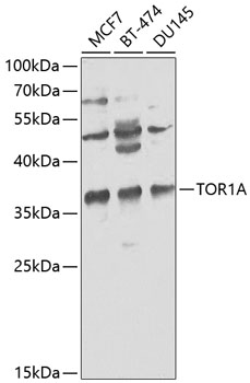 Anti-TOR1A Antibody (CAB2066)