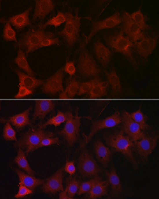 Anti-EIF4E2 Antibody (CAB4305)