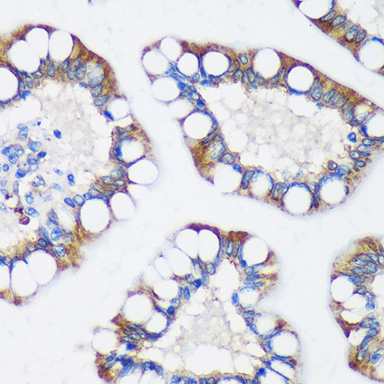 Anti-TRIM62 Antibody (CAB15855)