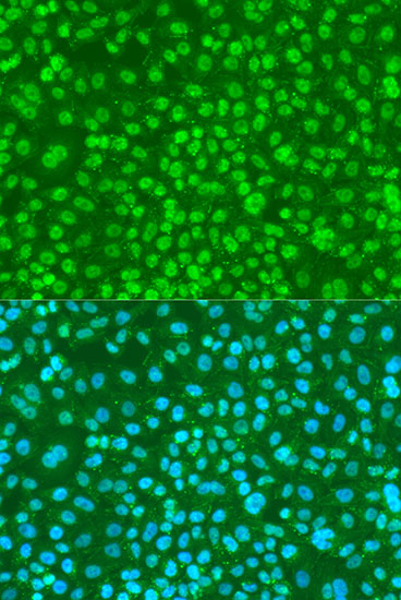 Anti-Phospho-FANCG-S383 pAb (CABP0833)