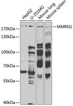 Anti-MMRN1 Antibody (CAB6658)