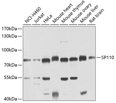 Anti-SP110 Antibody (CAB7492)