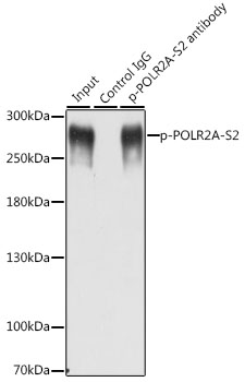 Anti-Phospho-POLR2A-S2 pAb (CABP0749)