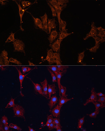 Anti-HSPB1 Antibody (CAB0240)