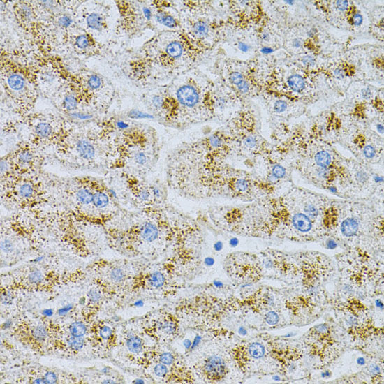 Anti-NPC2 Antibody (CAB5413)