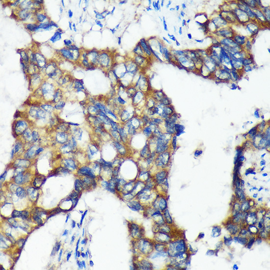 Anti-C18orf8 Antibody (CAB15825)