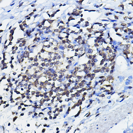 Anti-TP73 Antibody (CAB0385)