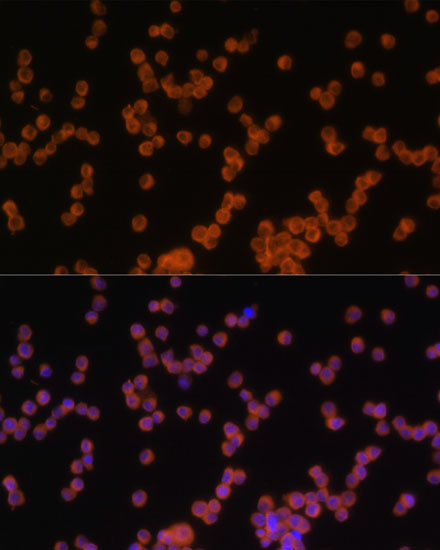 Anti-MyD88 Antibody (CAB0980)