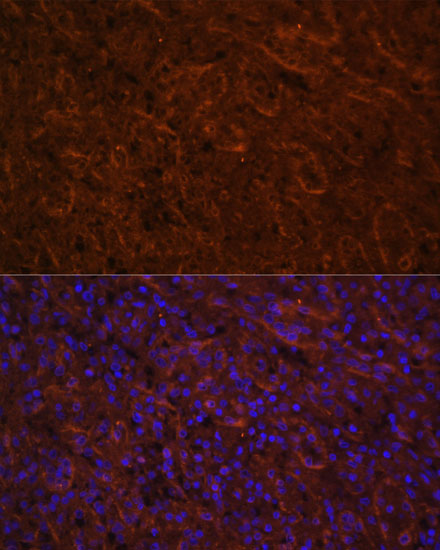 Anti-ICOS Antibody (CAB1811)