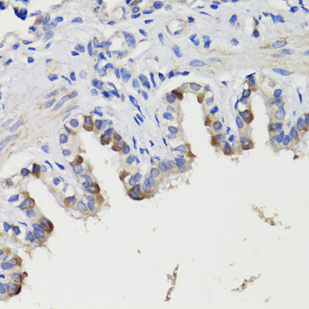 Anti-DEPDC6 Antibody (CAB17305)