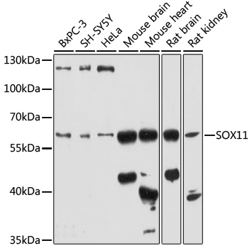 Anti-SOX11 Antibody (CAB17945)