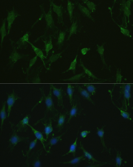 Anti-TRPV1 Polyclonal Antibody (CAB8564)