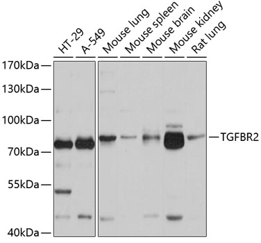 Anti-TGFBR2 Antibody (CAB1415)