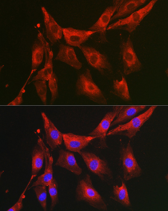 Anti-FBP1 Antibody (CAB5406)