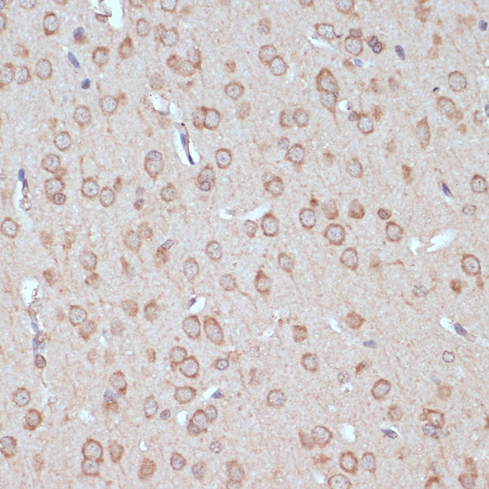 Anti-YAP1 Antibody (CAB1001)