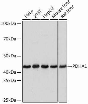 Anti-PDHA1 Antibody