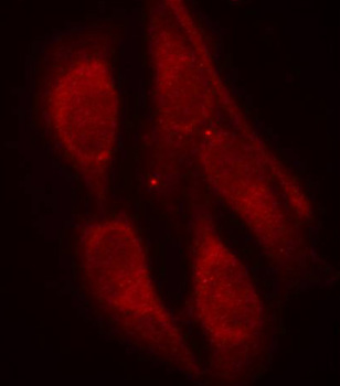 Anti-Phospho-SHC1-Y427 Antibody (CABP0266)