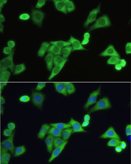 Anti-SLC2A9 Antibody (CAB14606)