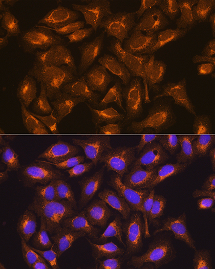 Anti-SDHB Antibody (CAB10821)