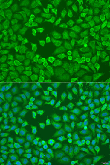 Anti-EIF3A Antibody (CAB0573)