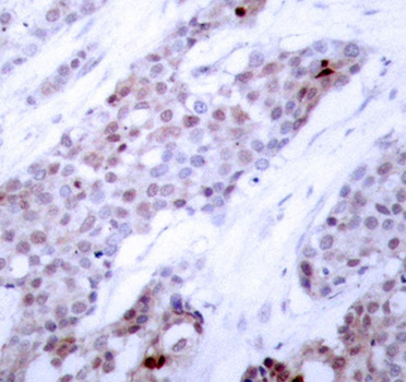 Anti-Phospho-ATF4-S245 Antibody (CABP0309)