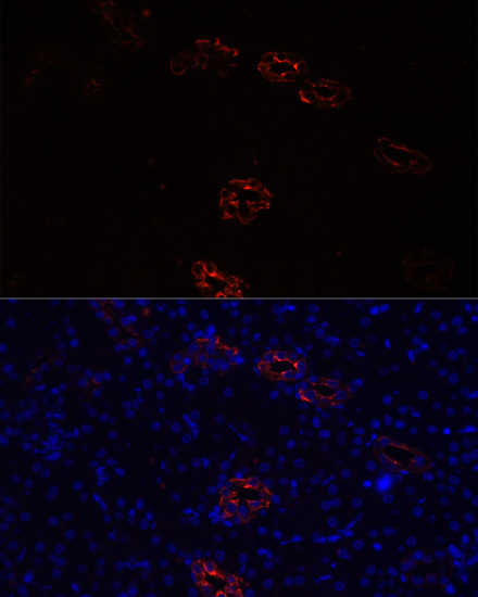 Anti-AQP2 Antibody (CAB16209)