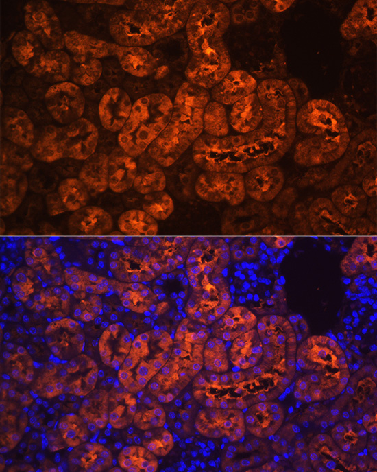 Anti-PCK1 Antibody (CAB2036)