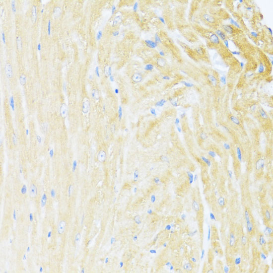 Anti-UQCC2 Polyclonal Antibody (CAB9986)