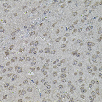 Anti-ATF4 Antibody (CAB7237)