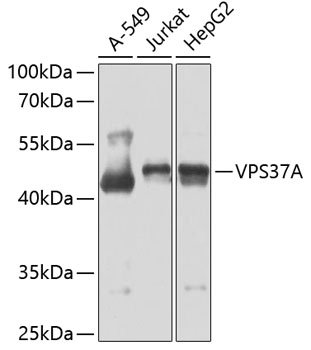 Anti-VPS37A Antibody (CAB7853)