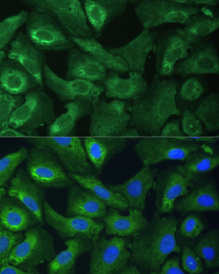 Anti-EIF3G Antibody (CAB4240)