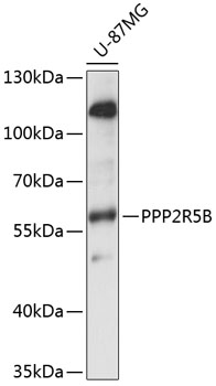 Anti-PPP2R5B Antibody (CAB14252)