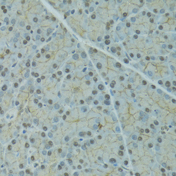 Anti-Alpha-2-antiplasmin Polyclonal Antibody (CAB9945)