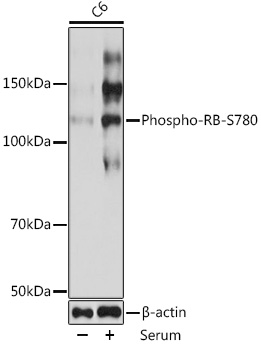 Anti-Phospho-RB-S780 Antibody (CABP0117)