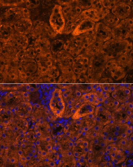 Anti-SCNN1G Antibody (CAB15097)