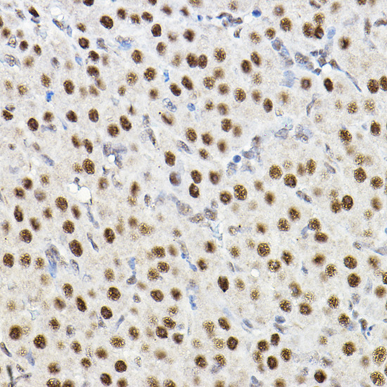 Anti-HIF1Alpha Antibody [KO Validated] (CAB16873)