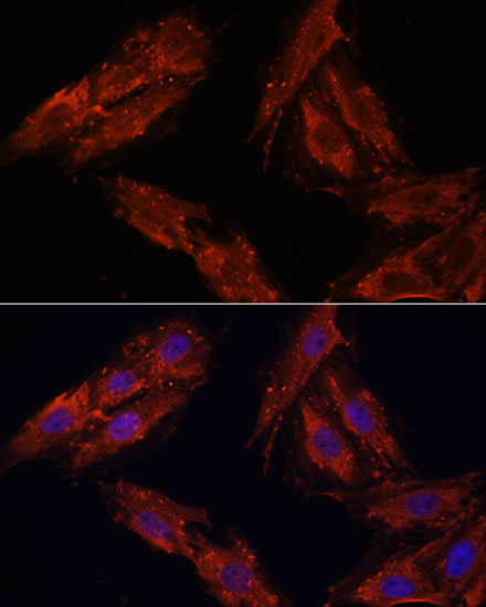 Anti-CDK6 Antibody (CAB16357)