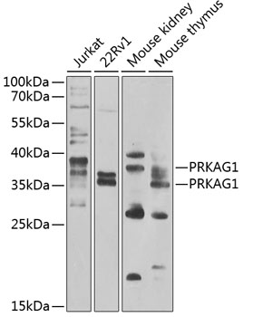 Anti-PRKAG1 Antibody (CAB7300)