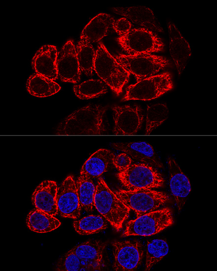 Anti-KRT17 Antibody (CAB0123)