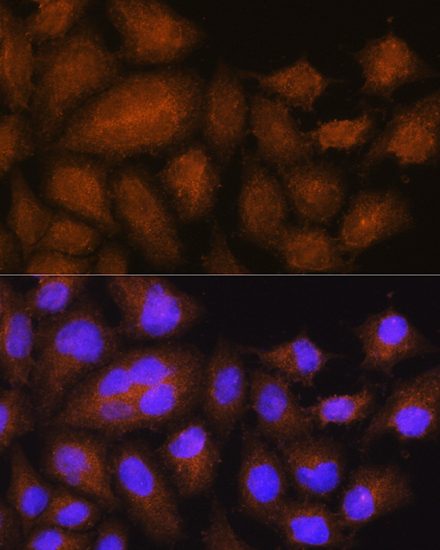 Anti-GSTT2B Antibody (CAB15583)