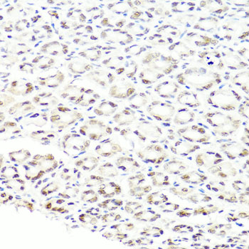 Anti-PRPF8 Antibody (CAB6053)