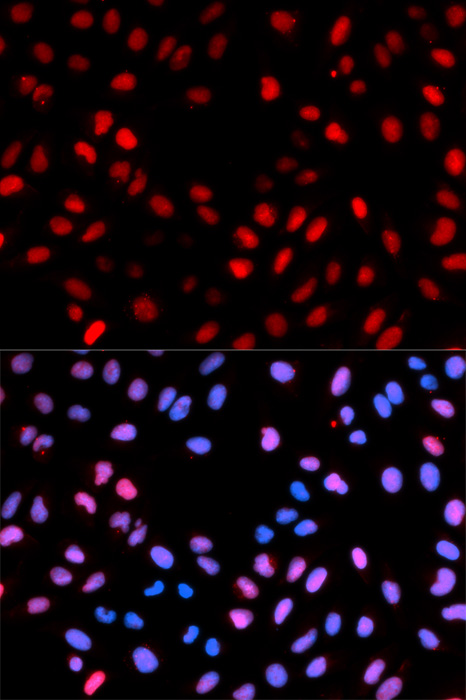 Anti-Phospho-RAF1-S621 Antibody (CABP0087)