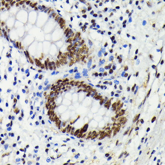 Anti-Phospho-JNK1/2/3-T183/T183/T221 mAb Antibody (CABP0631)